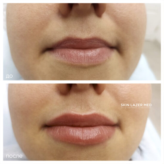 Минина ИС биорепарация Hyalrepair-0.6 LIPS